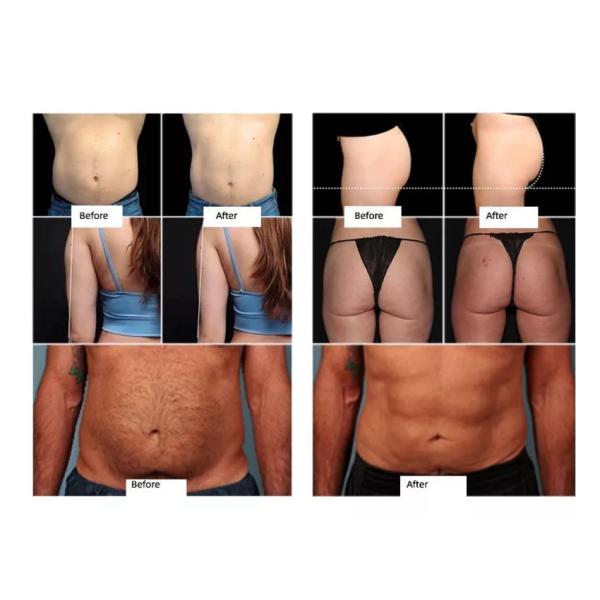 Black Slimming Beauty Machine 3000W Muscle Build Body Contouring Dual Handles