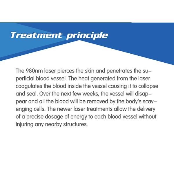 laser spider vein removal 200W power germany imported diode laser device 980 nm laser vein removal machine for sale