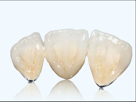 Teeth Color Cobalt Chromium Crown PFM High Noble Dental PFM