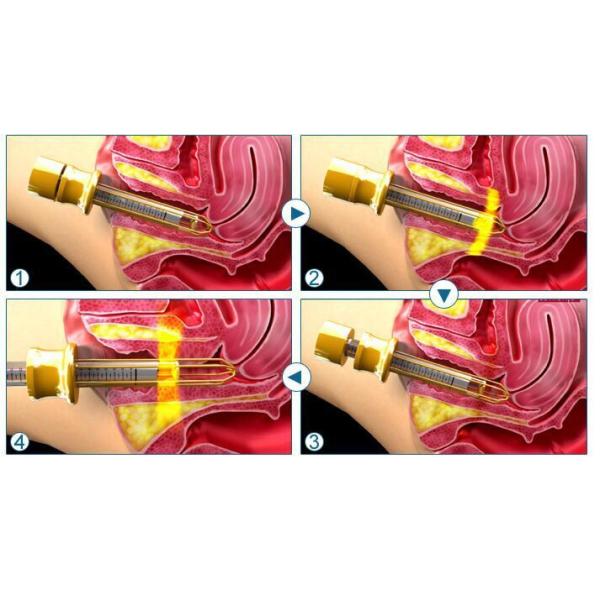 Multifunction Co2 Fractional Laser Machine 10600nm Pain - Free