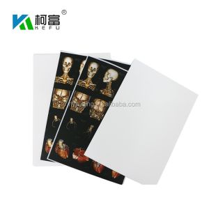 China A3 A4 Medical Waterproof Inkjet Film CT CR MR DR Digital X Ray Film on sale