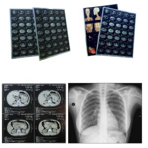 China Sheet Blue Xray Film Inkjet Medical Dry Film Clear Image on sale
