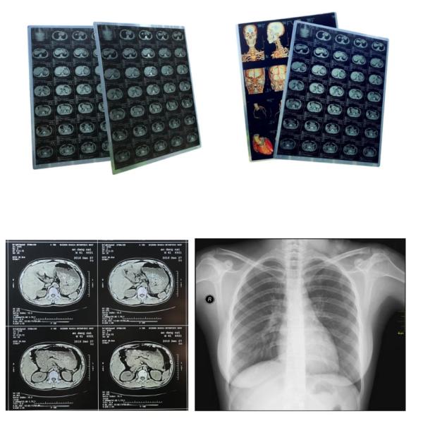 Buy Sheet Blue Xray Film Inkjet Medical Dry Film Clear Image at wholesale prices