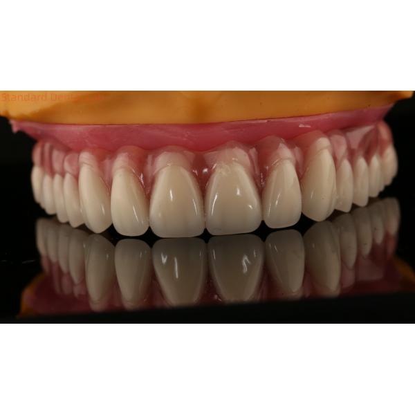Acrylic Partial Implant Over Denture Titianium Bar Full Denture Teeth Set Up