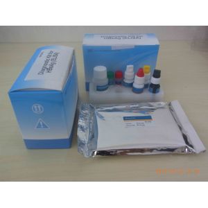 Ce Approved Hbsag Elisa Kit Medical Diagnostic Device