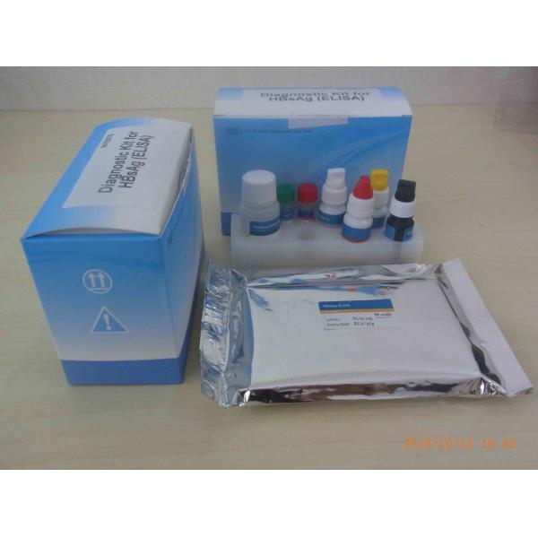 Buy Ce Approved Hbsag Elisa Kit Medical Diagnostic Device at wholesale prices