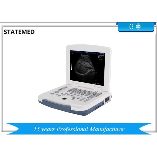 Buy B/W Laptop Trolley Ultrasound Scanner Diagnostic System For General Abdomen Scanning at wholesale prices