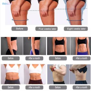 Electrical Muscle Sculpting Machine Emslim Neo RF Operation With 2 Handles