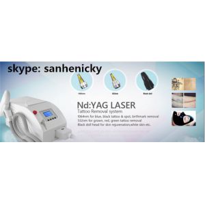 smart portable 532 / 1064 Q switch laser tattoo removal