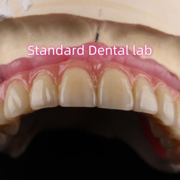 Fast Cement and Save Time Implant Products Dental Zirconia Crowns Bridge