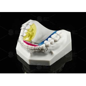 Customizable Spring Hawley Retainer Removable Teeth Position Retention