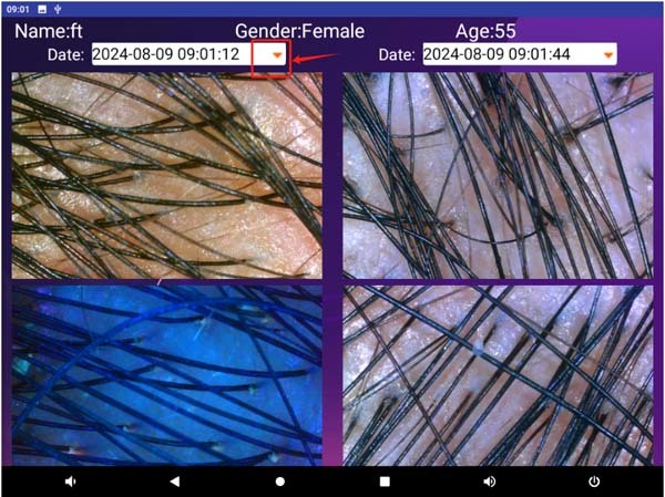 AI Hair Testing Machine High Precision Detection For Hair And Scalp Examination