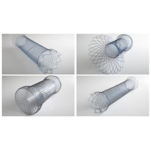 Respiratory Tract Self Expandable Metallic Stent 2mm