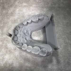 Easy Application 3D Resin Dental Easy Handling Cleanup Enhanced Efficiency