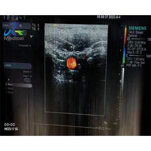 Siemens 14L5 Linear Array Ultrasound Transducer Maintenance Crystal Array And