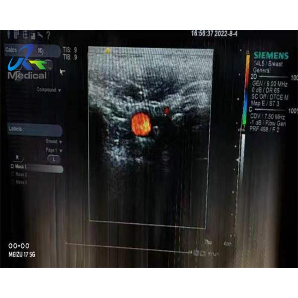 Siemens 14L5 Linear Array Ultrasound Transducer Maintenance Crystal Array And