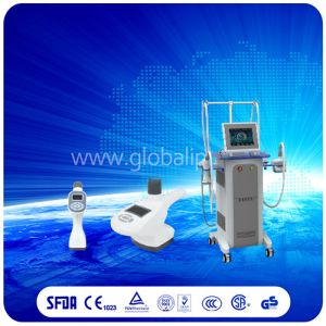 Weight Loss Vacuum cavitation system , hifu liposonix focus ultrasound body