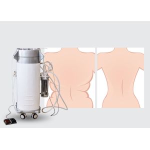 300W Surgical Liposuction Machine for Upper / Lower Back Liposuction
