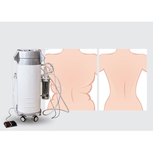 300W Surgical Liposuction Machine for Upper / Lower Back Liposuction