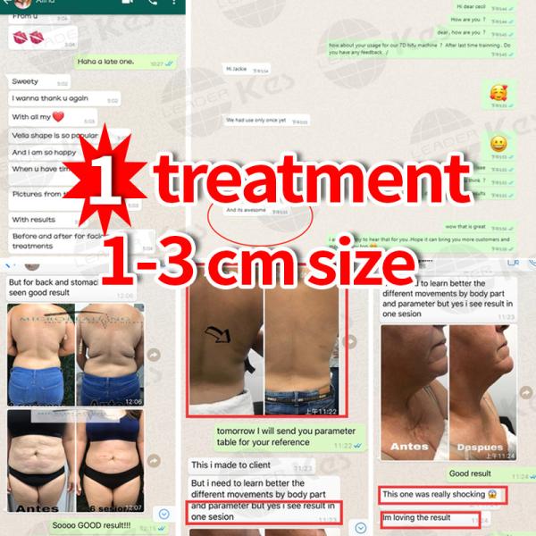 Fractional RF Skin Resurfacing Wrinkle Removal Machine 1MHz RF Beauty Equipment