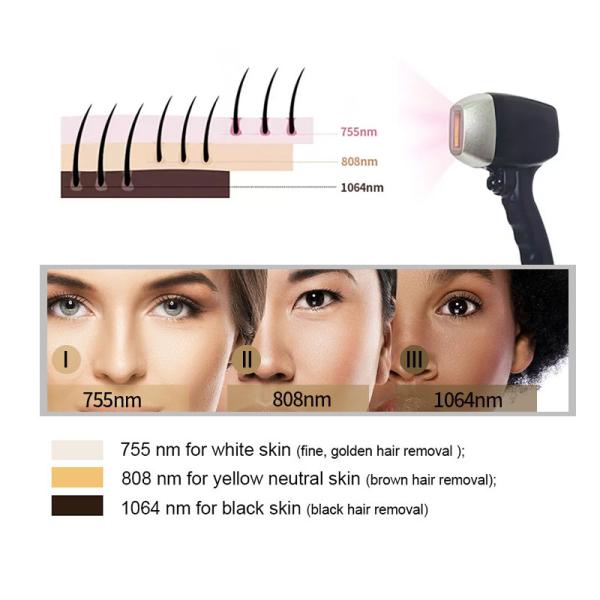 Fast Painless Diodo Laser Machine Hair Removal CE FDA Certificate