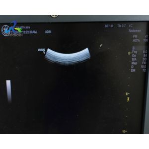 GE 4C-RS Convex Probe Ultrasound Transducer Lens Replacement