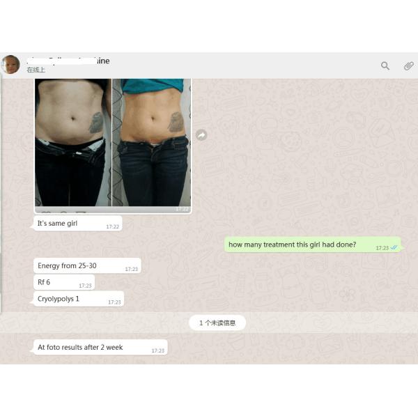 Beautiful Design High Quality Manufacturer Direct Sale Portable Cryolipolysis Machine For