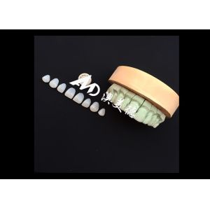 Transform Your Smile with IPS emax Press Porcelain Veneers Strength Aesthetics