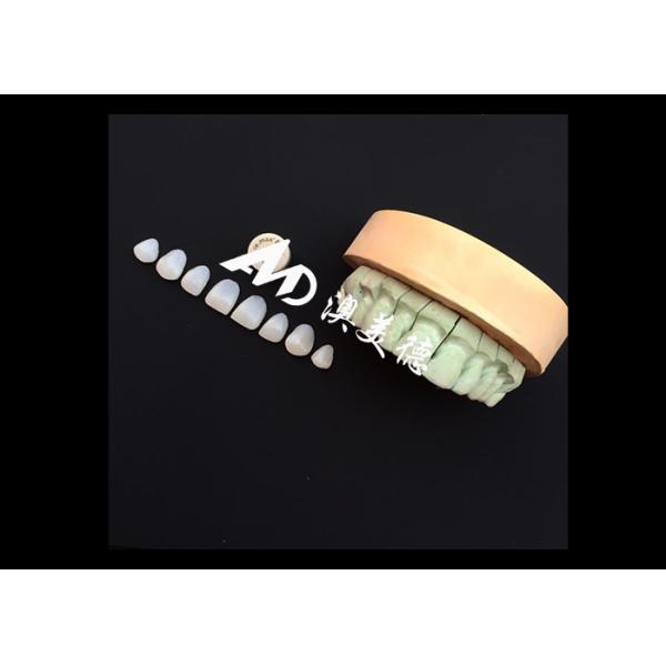 Transform Your Smile with IPS emax Press Porcelain Veneers Strength Aesthetics