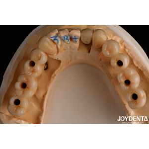 High Translucency Multilayered Full Contour Zirconia Natural looking 1200 HV