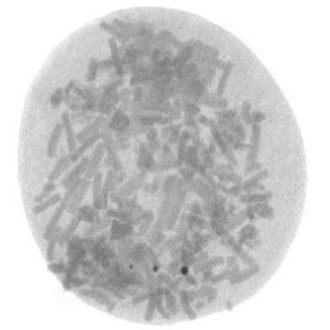 High Resolusion Food Scanner Machine Unicomp UNX4015N Detect Glass Ceramic