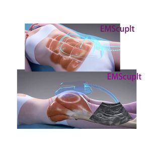 100Hz Electromagnetic Muscle Training EMS EMShapeing Machine