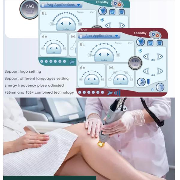2024 755nm Alexandrite Laser Hair Removal Machine with 15 Inch Color Touch Screen