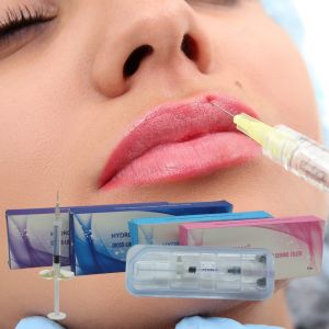 Cross-Linked Hyaluronic Acid Dermal Filler With Lidocaine Facial Injection