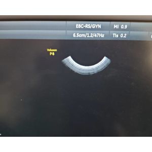 GE E8C-RS Compatible Ultrasound Probe Intracavity Transducer Electronic