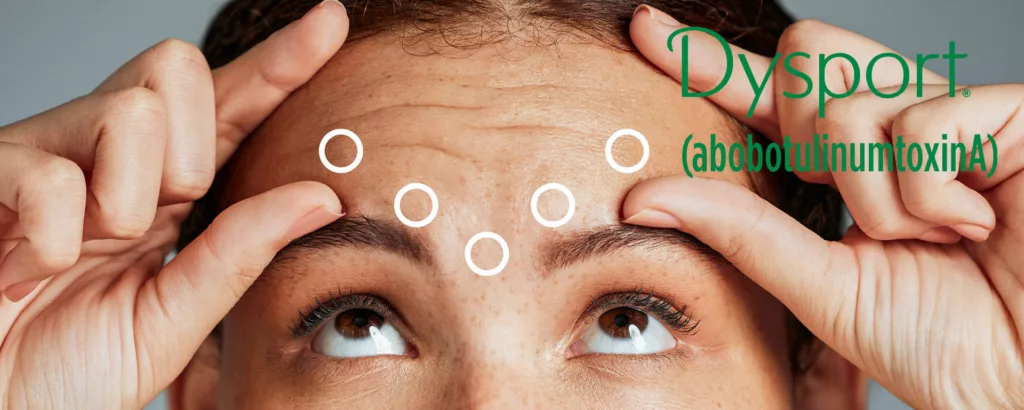 Dysport 500 For Injection abobotulinumtoxinA Botox 500U