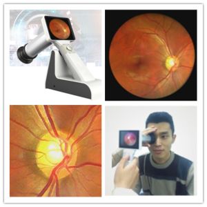 Portable Handheld Wifi Digital Ophthalmoscope For Eye Fundus