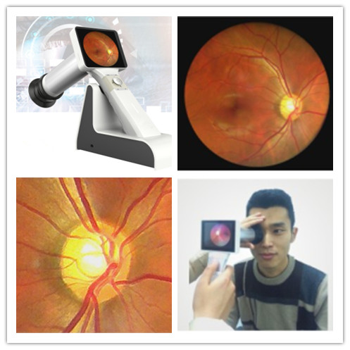 Portable Handheld Wifi Digital Ophthalmoscope For Eye Fundus