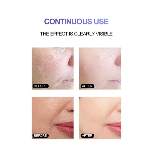 30ml Essence Face Serum 100% Pure Redness Radiant Skin Advanced Rosacea 1