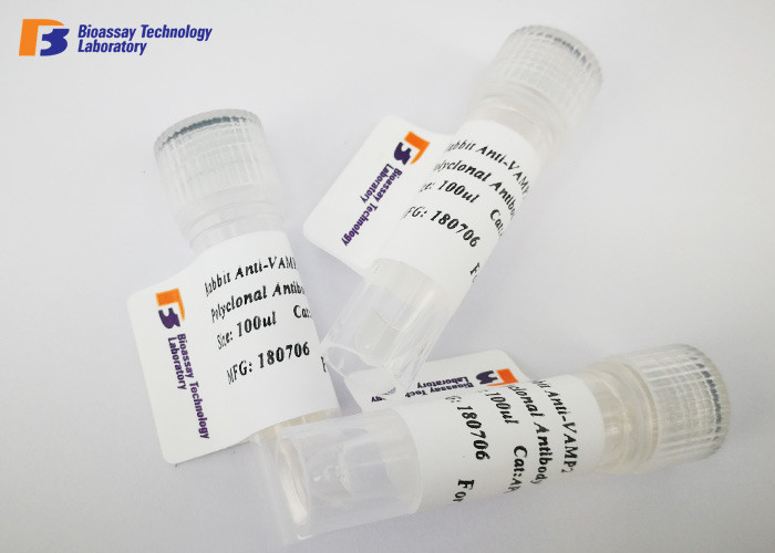 Buy Mouse Anti ENO2 Custom Monoclonal Antibody with NSE Fusion Protein at wholesale prices