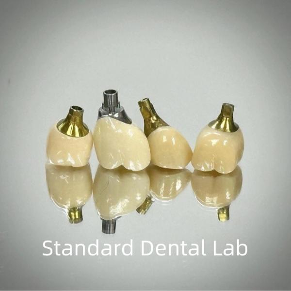 Buy Professional Zirconia Screw Retained Implant Crown Titanium CAD CAM at wholesale prices