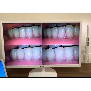 5G Wireless Wifi Dental Intraoral Camera 19 Inch Dental Implant LCD Monitor