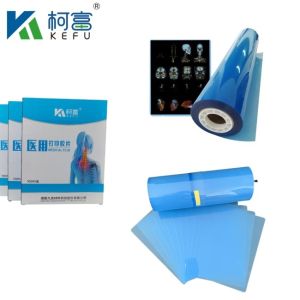 Blue Inkjet Film Medical X-Ray/CT/DR Dry Scan Film For X-Ray Laser Image Printer