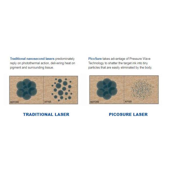 2000mj Q Switch Yag Laser Machine , Cynosure Tattoo Removal Machine For Tattoo Studio