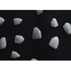 Long Lasting Dental EMAX Veneer Fabricated With All Ceramic Zirconium Material