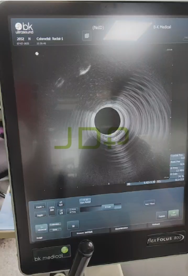 BK Medical 2052 Intra-cavitary Ultrasound Probe