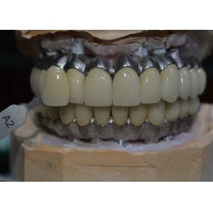 Prioritizing Patient Satisfaction Our Commitment To Quality Dental Implant