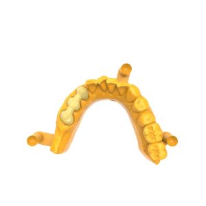 Low-Viscosity Permanent Crown Bridge Resin For Easy Handling