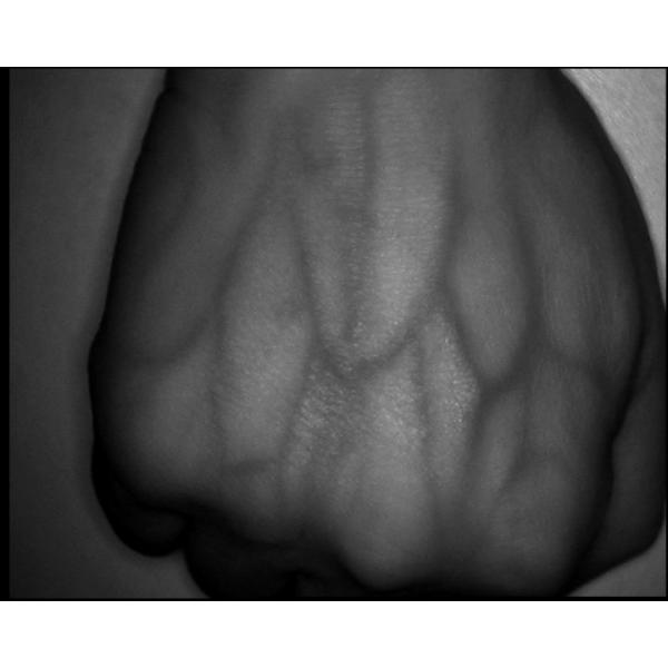 Buy Portable Ambulance Infrared Vein Finder Internal Lithium Battery at wholesale prices