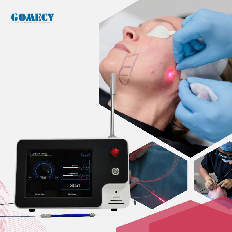 980 1470nm Diode Laser Body Sculpting Machine for Fat Melting and Skin